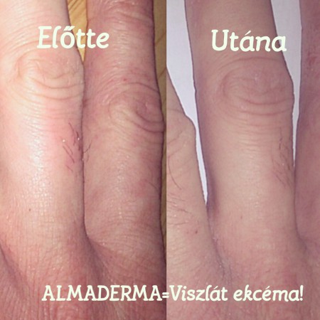 https://www.instagram.com/almaderma.hu/
